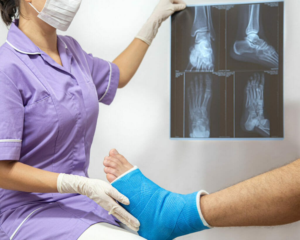 A woman is holding a cast on her foot.