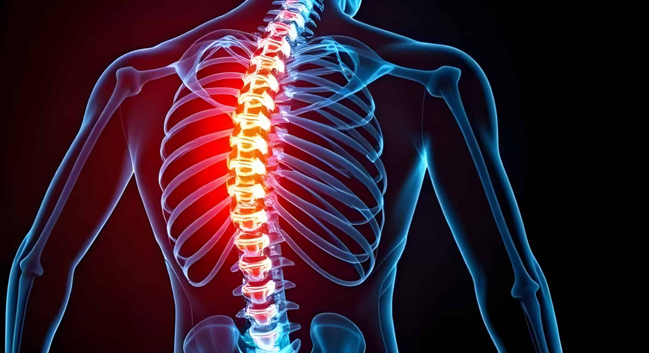 Digital illustration of human upper body showing spine and ribcage; thoracic vertebrae highlighted in red to indicate pain or inflammation.